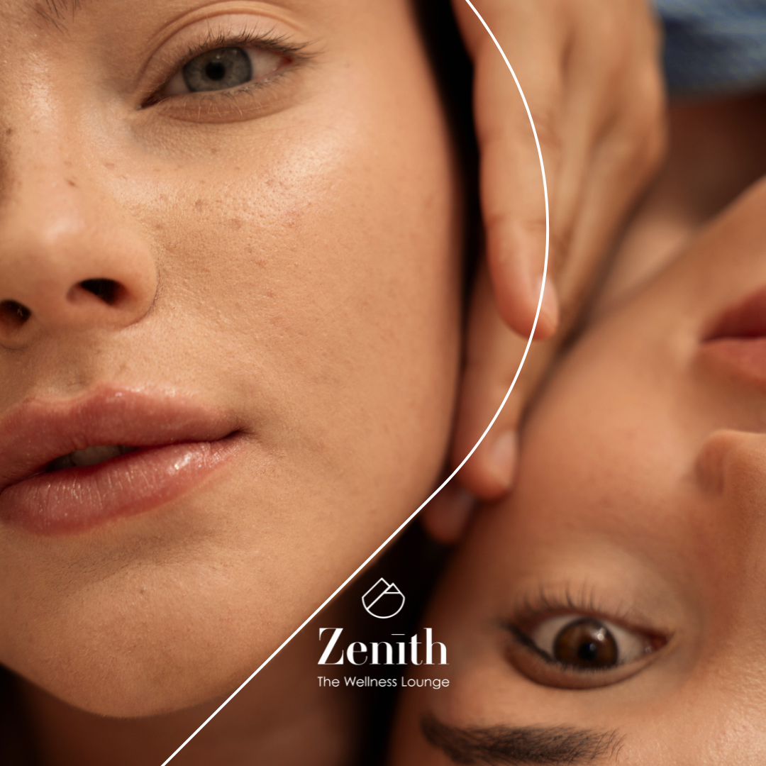 Close-up of two faces with smooth skin, one upright and one upside down, separated by a white curved line—a Creative Visual Design for "Zenith The Wellness Lounge." Logo appears at the bottom center, perfect for your brand kit. Opdee Digital Marketing